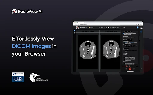 RadioView.AI - Chrome Extension - AI Tool Ocean